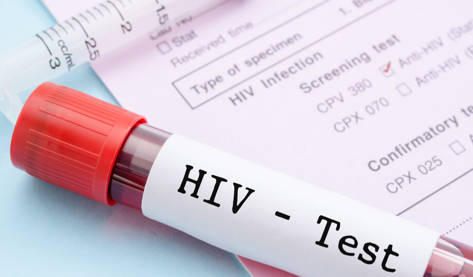 vitros hiv combo test